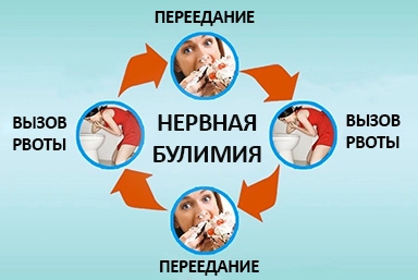 Лечение булимии в Явасе